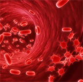 Having type 2 diabetes is more prone to blood cancer