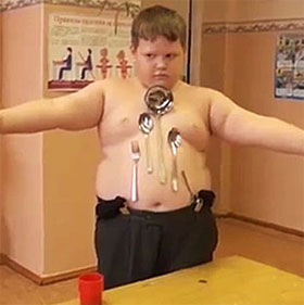He can suck metal after an electric shock accident