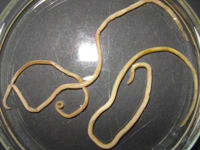 Headaches, epilepsy because of parasitic roundworm in cats and dogs