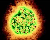 Hepatitis A is spread through eating and drinking