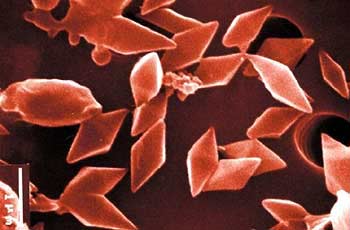 Heroes of the worm - Bacteria Thuring (Bacillus thuringiensis)