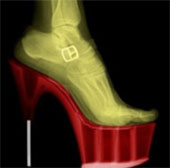 High heels - painful for beauty