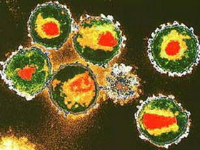 HIV still kills people after thousands of years