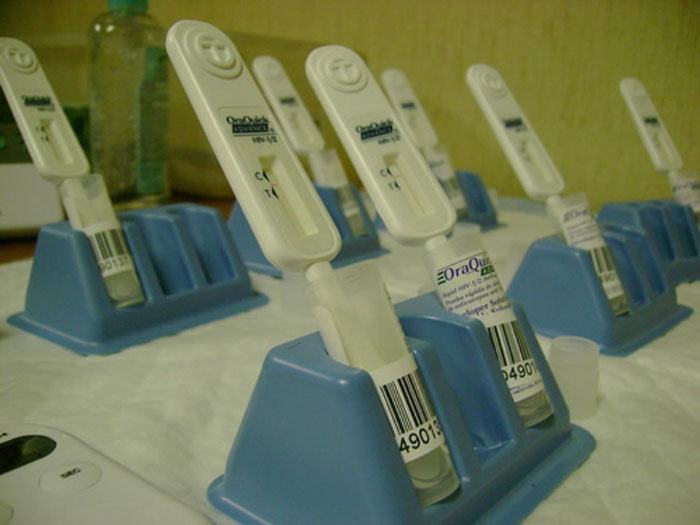 Home HIV testing equipment is coming soon