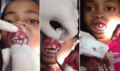 Horror discovered maggots in favor of girls