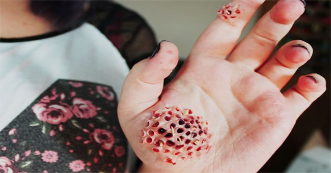 Horror diseases are not for the weak