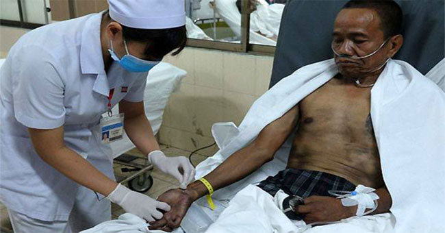 How dangerous is a respiratory burn?