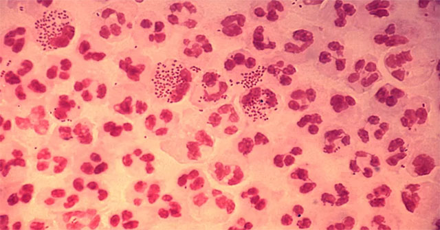 How dangerous is gonorrhea?