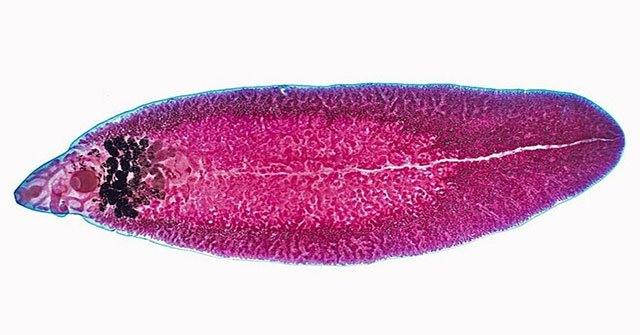 How dangerous is liver fluke infection?