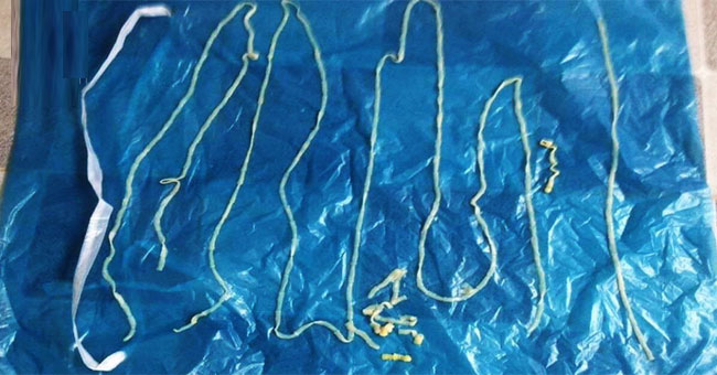 How dangerous is the tapeworm infection?