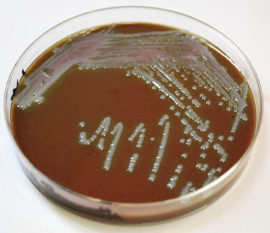 How does poisonous bacteria pass through the body defense system?
