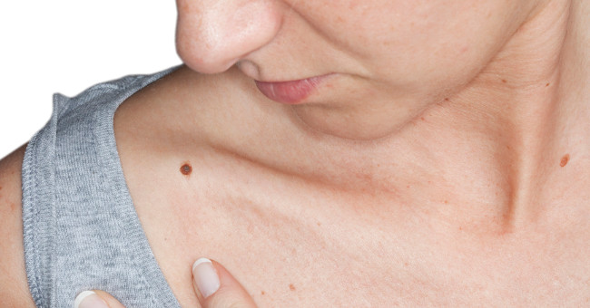 How does skin cancer destroy people?