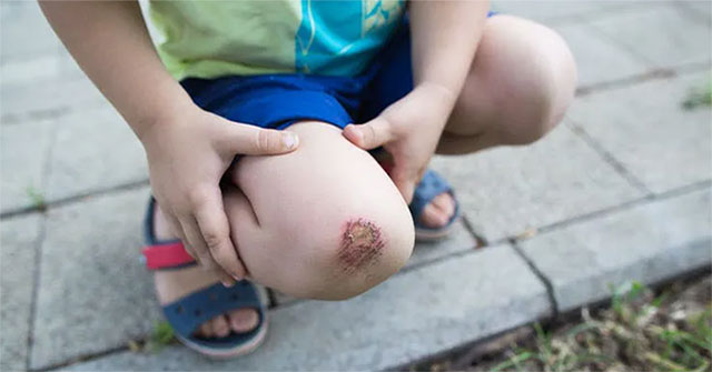 How does the wound heal?
