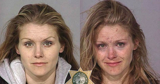 How drugs destroy the human face