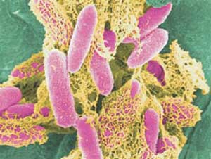 How is the bacterium