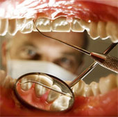 How often should we go to the dentist?