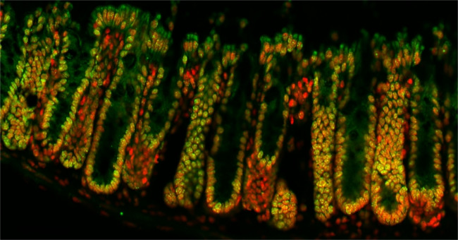 How the microorganisms in the gut 'hack' control your genome