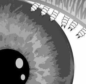 How to catch maggots nest in the eyes of the Mongols