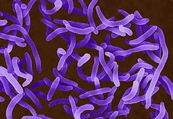 How to treat acute diarrhea