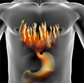 How to treat heartburn, indigestion without medication