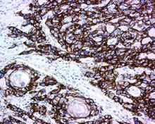 Human antibodies protect mice from bird flu