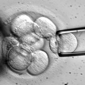 Human embryo production from genes of 3 people