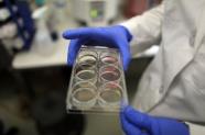 Human embryonic stem cells and vision of the elderly