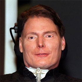 Human head implant surgery is about to come true?