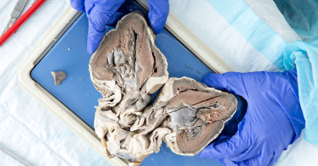 Humans will be able to use pig heart instead of human heart thanks to this genetic technique