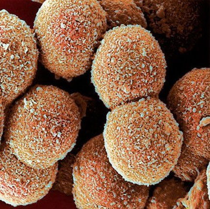 Hunger-causing hormones increase life expectancy