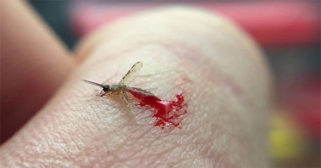 I was burned by a contaminated mosquito at Chernobyl