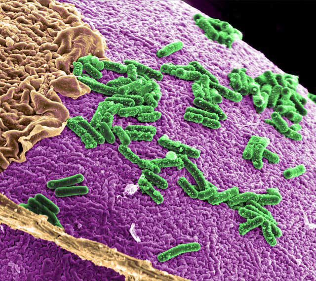 Identify criminals through ... bacteria