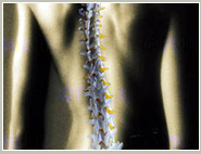 Identify genes that cause spina bifida