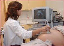 Identify the cause of childbirth with Down syndrome