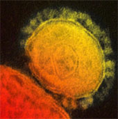Identify two antibodies that promise to fight MERS