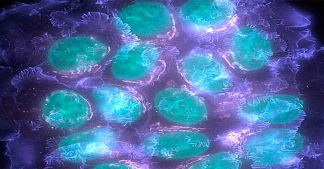 Identifying mutant genes capable of causing breast cancer
