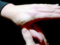 Implant the subcutaneous chip instead of the password