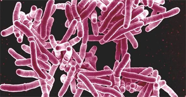Implants can kill up to 98% of bacteria