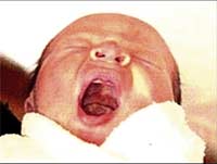 Infant death due to gene disorder?
