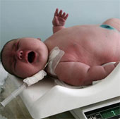 Infant weight is related to autism