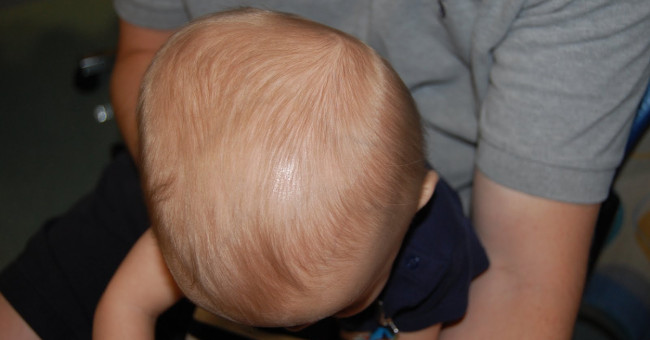 Infant's head: what mom should know!