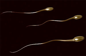 Infertility due to immunity