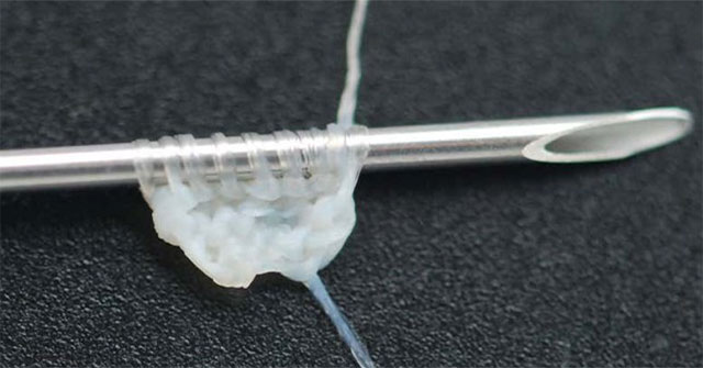 Initiative to use human skin sutures for suturing patients