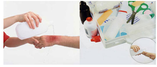 Inkjet technology heals wounds quickly