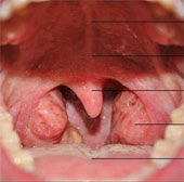 Instructions for taking care of patients after tonsillectomy