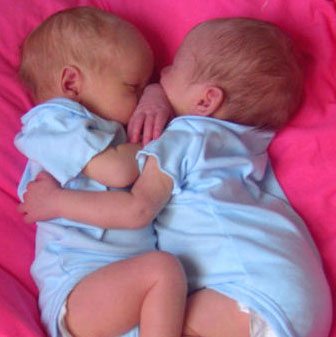 Interesting things about twins that you may not know yet