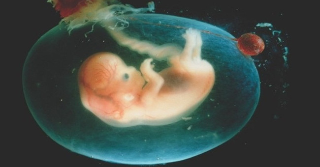 Interesting truth about babies born in 'wrap things' 80,000 cases 1