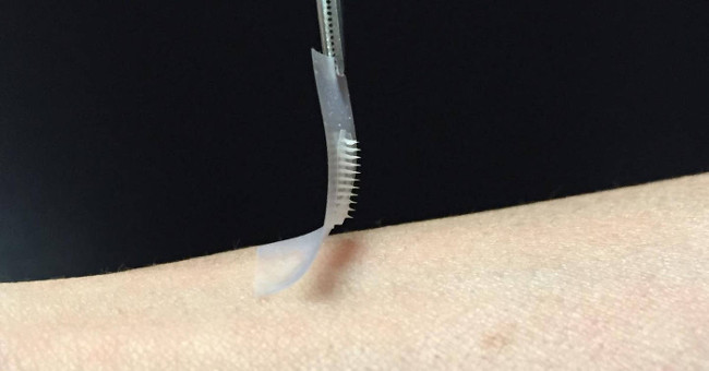 Invention helps people with diabetes do not need to pay attention to regular insulin injections