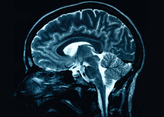 Ion Magie can help maintain long-term memory mechanism
