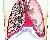 Is hiccups sick?